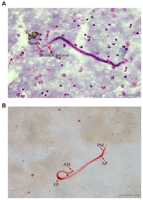 Unveiling zoonotic threats: molecular identification of Brugia sp. infection in a lion